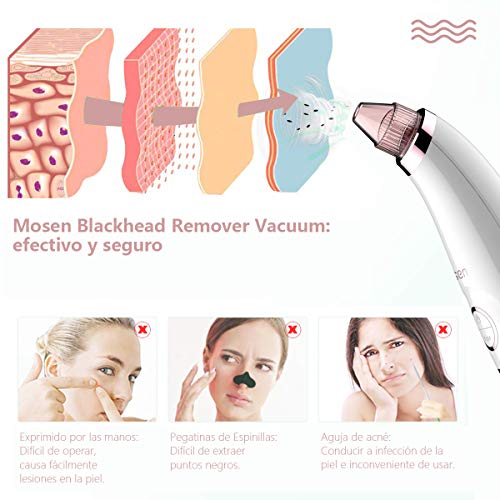 Mosen Limpiador de Poros Succionador de Puntos Negros Limpiador Facial Blackhead Remover Extractor Puntos Negros USB Recargable con Pantalla LED 5 Cabezales Pulidores Faciales