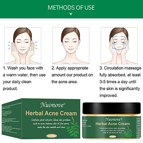 Crema Antiacne, Acné Crema, Anti Acne, Acne Tratamiento, Acne Cream, Reducir los Puntos negros, Equilibrar el Agua y el Aceite, la Crema Contra el Acné Espinilla, Regenera la piel, 100 g