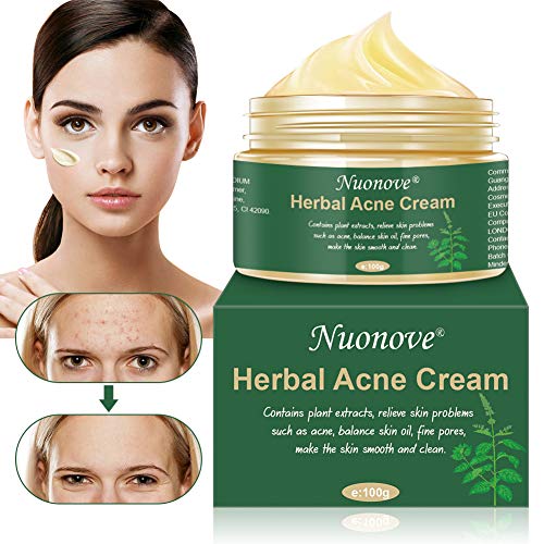 Crema Antiacne, Acné Crema, Anti Acne, Acne Tratamiento, Acne Cream, Reducir los Puntos negros, Equilibrar el Agua y el Aceite, la Crema Contra el Acné Espinilla, Regenera la piel, 100 g