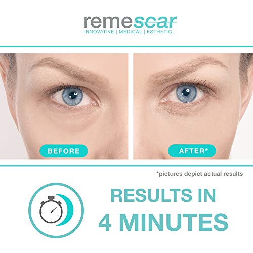 Remescar - Remescar Bolsas y ojeras - Crema para las bolsas de los ojos - Corrector de ojeras - Elimina las bolsas - Tratamiento para las bolsas de los ojos al instante para hombre y mujer