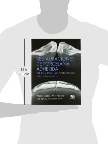 RESTAURACIONES DE PORCELANA ADHERIDA EN LOS DIENTES ANTERIOR