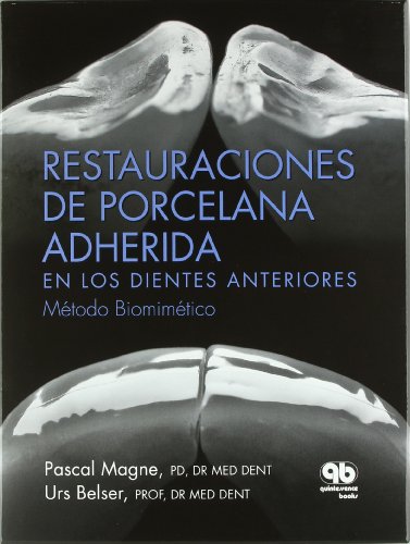 RESTAURACIONES DE PORCELANA ADHERIDA EN LOS DIENTES ANTERIOR