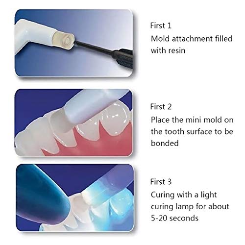 siwetg Molde De Accesorios De Botón Lingual Mini Dental para Hacer Hebilla De Lengua