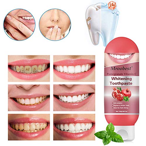 Teeth Whitening Toothpaste, Pasta Dental, Stain Removal Whitening Toothpaste, Pasta de dientes rica en frutas, Elimina las manchas y blanquea, Protege los dientes durante mucho tiempo