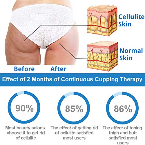 Ventosas Celulitis, Ventosa Anticelulitica, Cellulite Cup, Adecuado para glúteos, Abdomen, Brazos, Piernas, Etc anticelulítico, Reduce grasa, Antienvejecimiento