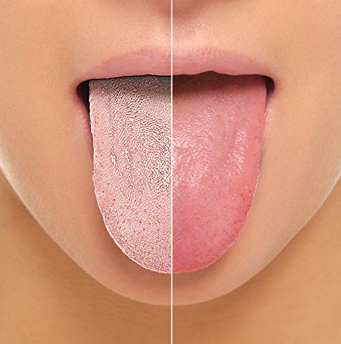 YogaMedic Limpiador de Lengua [2x] - 100% acero inoxidable, naturalmente Anti-Microbiano para combatir el mal aliento - raspador de lengua - tongue scraper