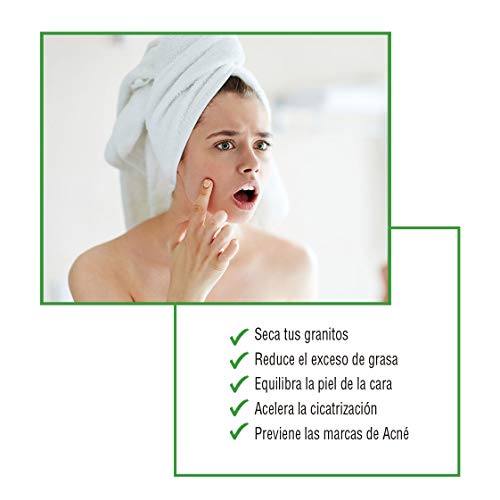 ZOWIX Crema anti acne. Elimina espinillas y granos. Tratamiento facial antiacné natural y efectivo con A. Salicílico y Oxido de Zinc. Todo tipo de acné. 50 ml