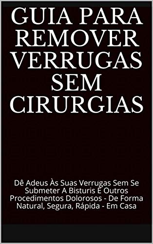 Guia Para Remover Verrugas Sem Cirurgias: Dê Adeus Às Suas Verrugas Sem Se Submeter A Bisturis E Outros Procedimentos Dolorosos - De Forma Natural, Segura, Rápida - Em Casa (Portuguese Edition)