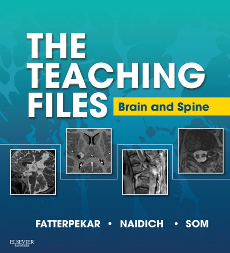 The Teaching Files: Brain and Spine Imaging E-Book: Expert Consult - Online and Print (English Edition)