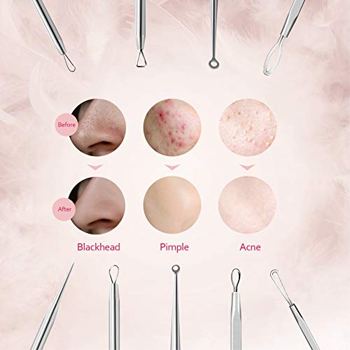 IZUKU Extractor de Puntos Negros Kit de 6Pcs [Nueva Caja de Metal] Blackhead Remover Aguja de Acné para Quita Espinillas Granos Comedones