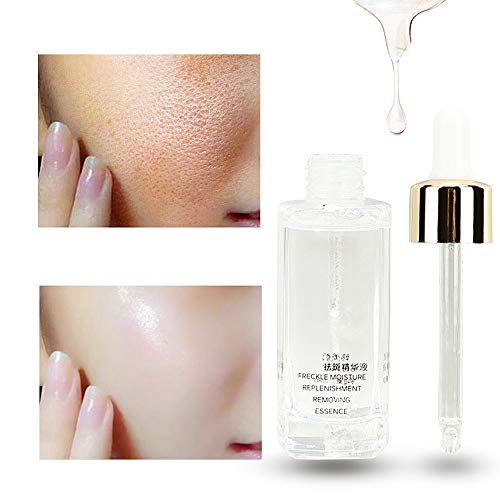 Manchas Cara Eliminación,Suero Eliminación de Pecas Tratamiento Anti Cicatrices Cicatrices Faciales,Manchas Oscuras Blanqueamiento Blemish Eliminación Suero Reduce Manchas Edad Pecas