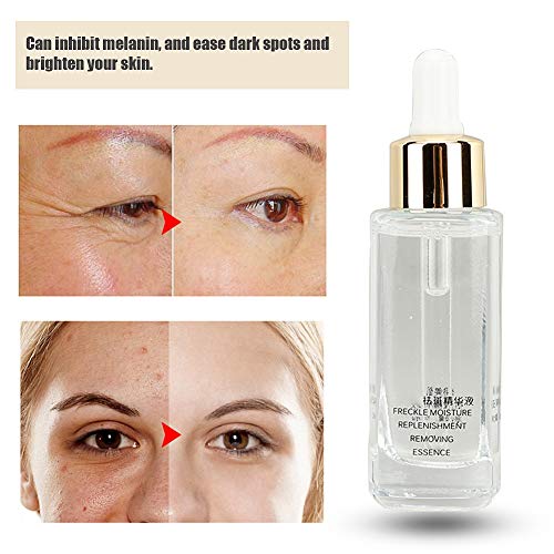 Manchas Cara Eliminación,Suero Eliminación de Pecas Tratamiento Anti Cicatrices Cicatrices Faciales,Manchas Oscuras Blanqueamiento Blemish Eliminación Suero Reduce Manchas Edad Pecas