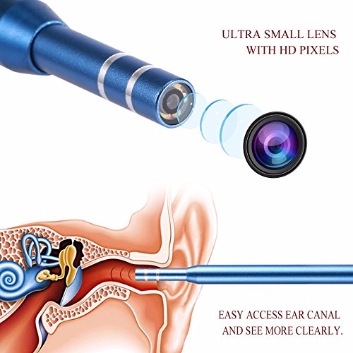 SISHUINIANHUA 3 en 1 Limpiador de Orejas Endoscopio de Alta Definición Orejera Visual Cuchara para Oído Mini Cámara Limpiador de Oídos Cuidado de la Salud Herramienta USB Hogar Médico