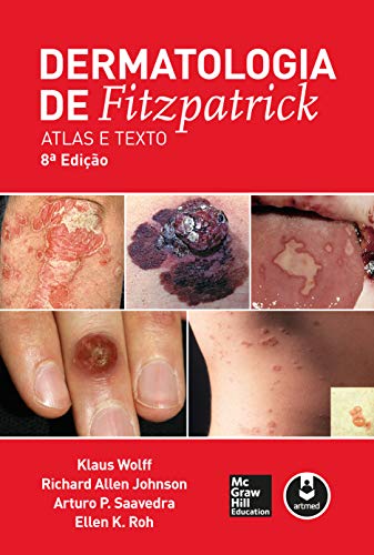 Dermatologia de Fitzpatrick: Atlas e Texto (Portuguese Edition)